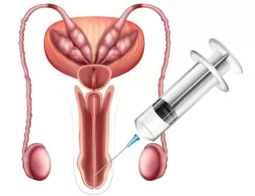 Penis Büyütme