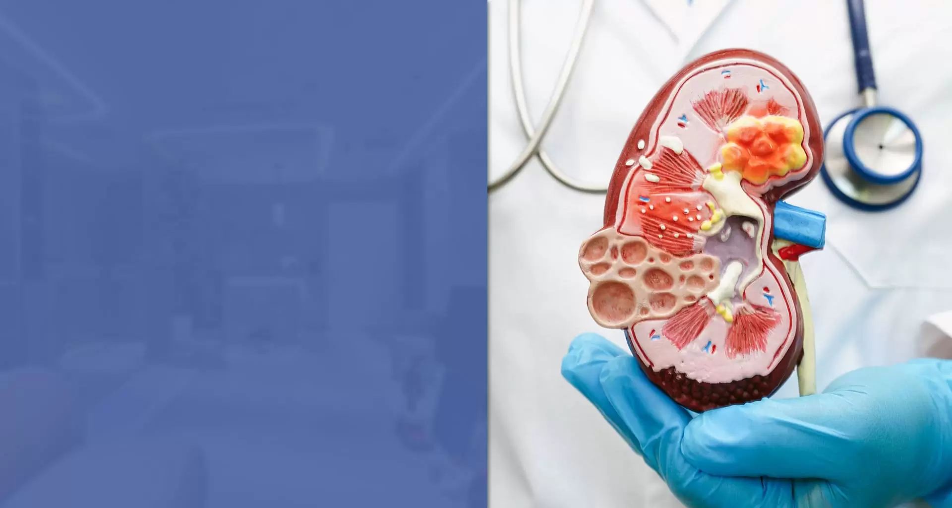 Böbrek Taş Hastalığı